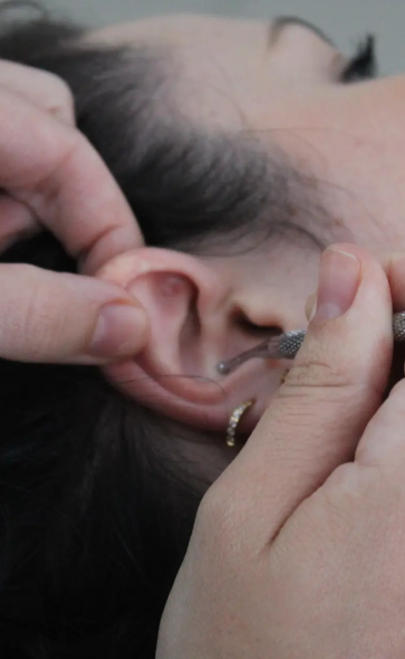 auriculoterapia_enbaeza